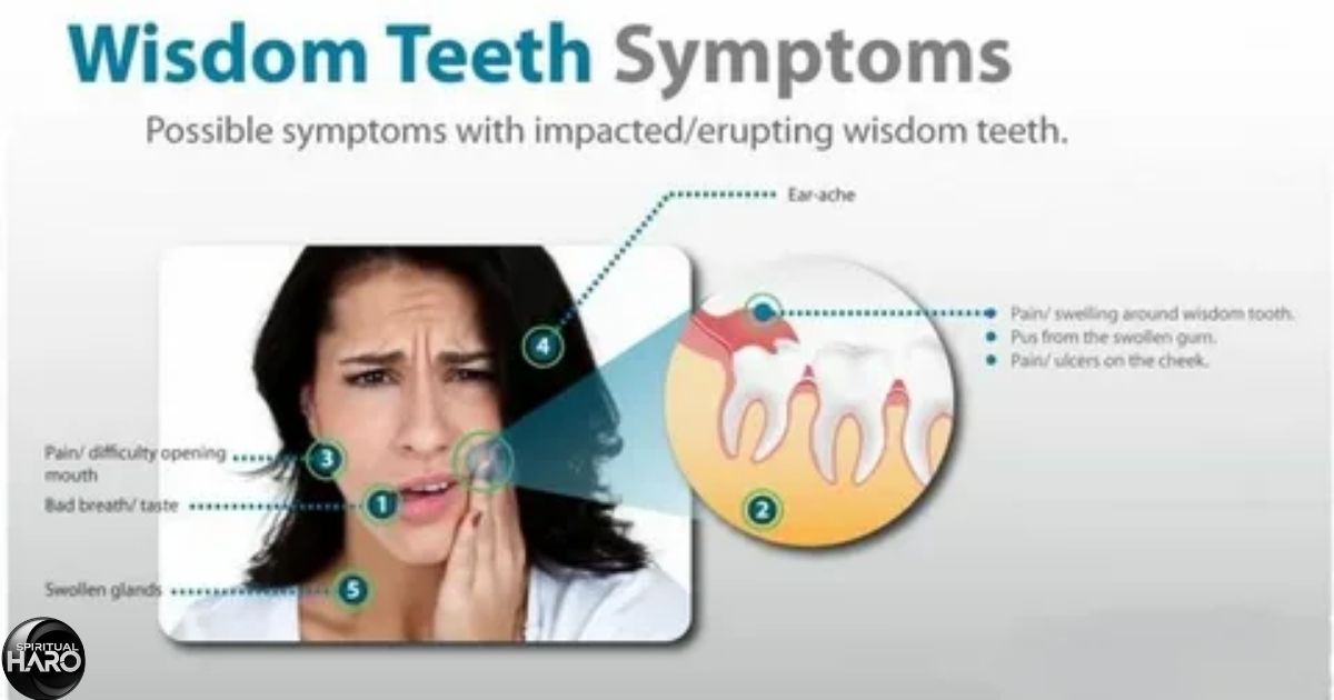 12 Spiritual Meaning of Wisdom Teeth